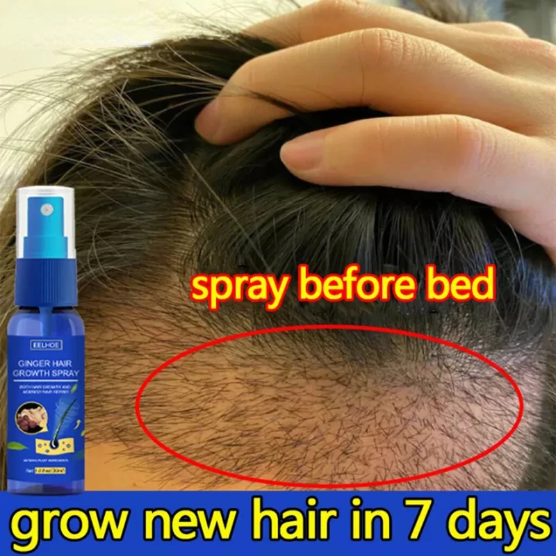 Perfume Zara - Hair Growth สเปรย์ส่งเสริม Fast หนาอีกต่อไปสารสกัดจากขิงป้องกันหัวล้านชุ่มชื่นหนังศีรษะ Anti
