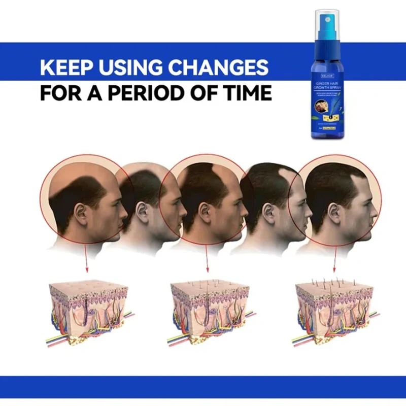 Hair Growth สเปรย์ส่งเสริม Fas - Perfume Zara บทวิจารณ์และราคา